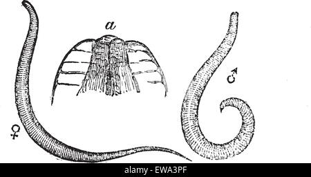 Pinworm or Enterobius or Threadworm or seatworm, vintage engraved ...