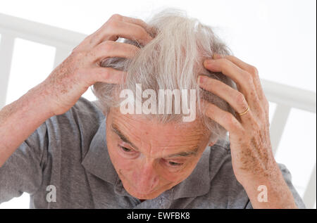 ITCHING IN A SENIOR Stock Photo