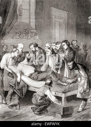 The first public demonstration of the use of inhaled ether as a surgical anesthetic in 1846 by an American dentist,  William Thomas Green Morton (1819 – 1868). Stock Photo