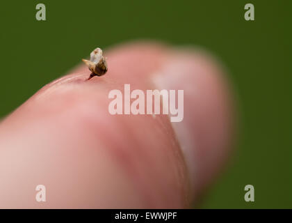 honey bee (Apis) stinger - along with part of digestive tract and nerves and muscles - in a human finger Stock Photo