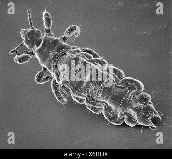 Pediculus humanus capitis, head louse, SEM Stock Photo