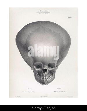 illustration from 'Traitè de phrénologie humaine et comparée (Paris, 1832-1835); by Joseph Vimont 1795 - 1857. phrenology was founded in the early 19th century by Franz Josef Gall (1758-1828). It holds that different intelligences and personality traits h Stock Photo