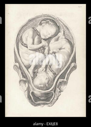 Illustration from 'A sett of anatomical tables, with explanations, and an abridgment, of the practice of midwifery'. (London: 1754). By William Smellie (1697 – 1763) a Scottish obstetrician Stock Photo