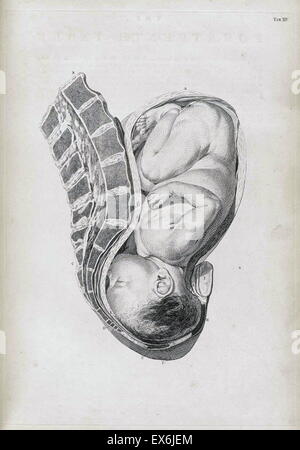 Illustration from 'A sett of anatomical tables, with explanations, and an abridgment, of the practice of midwifery'. (London: 1754). By William Smellie (1697 – 1763) a Scottish obstetrician Stock Photo