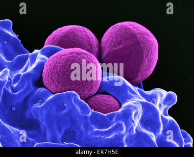Colorized scanning electron micrograph (SEM) of four spherical methicillin-resistant Staphylococcus aureus (MRSA) bacteria. Stock Photo