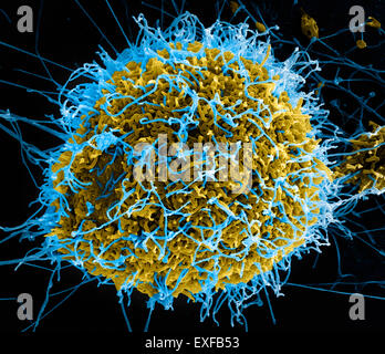 Filamentous Ebola virus particles (colored blue) budding from a chronically-infected VERO E6 cell (colored yellow) Stock Photo
