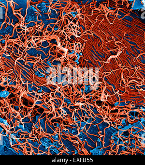 Filamentous Ebola virus particles (colored red) budding from a chronically-infected VERO E6 cell (colored blue) Stock Photo