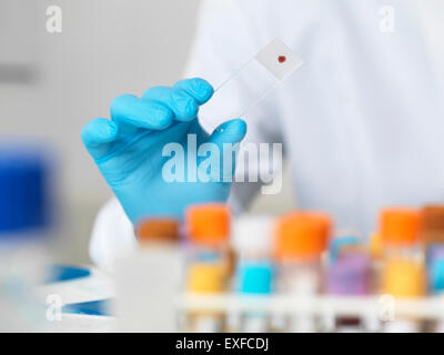 Close up of scientists hand holding blood sample on a glass microscope slide for medical testing Stock Photo