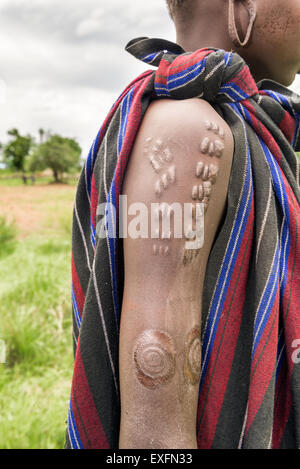 Traditional scarification typical for the Mursi tribe in Ethiopia Stock Photo