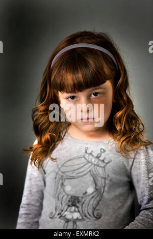 Portrait of young girl with a bruise or black eye on her left side, . This is a model, model released. Vertical color photograph Stock Photo