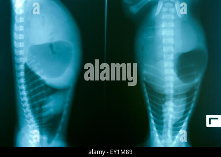x ray picture of wild animal skeleton Stock Photo