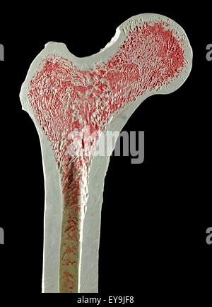 Cross section view of a human femur bone showing trabecula Stock Photo: 34207733 - Alamy