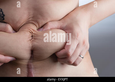 A woman with a tattoo grabbing the loose skin on her stomach after giving birth by c-section. Stock Photo