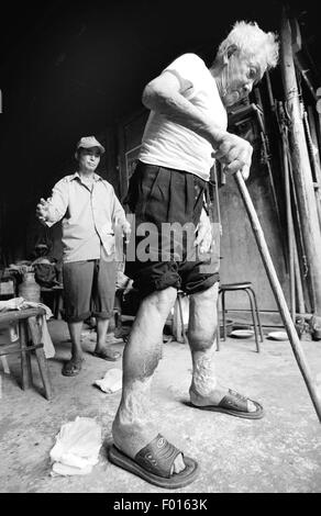 (150806) -- BEIJING, Aug. 6, 2015 (Xinhua) -- A victim of Japanese germ warfare committed in China during World War II walks with crutches in Yiwu, east China's Zhejiang Province, July 5, 2005. Invading Japanese troops set up 60 germ warfare units involved more than 10,000 troops from 1932 to 1945 in China and victimized at least 270,000 Chinese civilians. Japanese troops, including notorious Unit 731, developed and produced germ weapons based on bacteria experiments on human bodies and used germ weapons against Chinese civilians in battles and released plague, anthracnose and glande Stock Photo