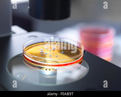 Petri dish containing bacterial culture being examined with inverted light microscope in microbiology lab Stock Photo