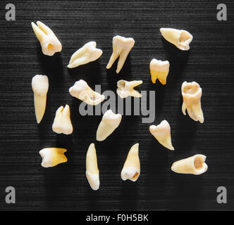 Extracted teeth with various defects Stock Photo