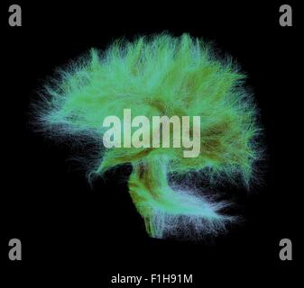 Human brain, 3D MRI scan Stock Photo - Alamy