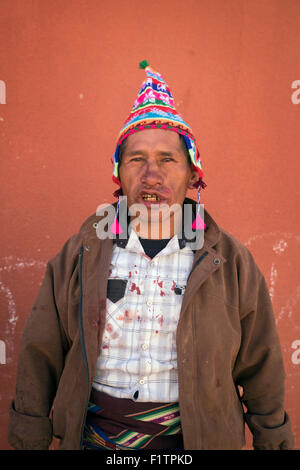 A man has several wounds on his face after being involved in a fight during the celebration of Tinku. Stock Photo