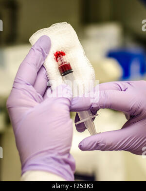 Medical Blood Gas, Checking for clot and removing air bubbles. Stock Photo