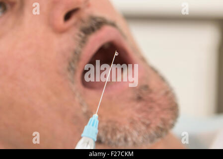 Syringe with hypodermic needle over patient's mouth, Munich, Bavaria, Germany Stock Photo