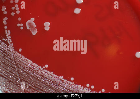 bacterial colonies growing in sheep's blood medium on a petri dish Stock Photo