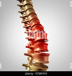 Spine pain and lower back disease and human backache with a three dimensional spinal body skeleton showing the vertebra and vertebral column in glowing red highlight as a medical health care concept for joint pain. Stock Photo