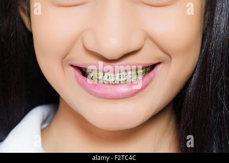 1 indian Teenager Girl Teeth Showing Stock Photo