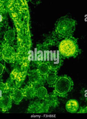 Colorized SEM Middle East respiratory syndrome Stock Photo