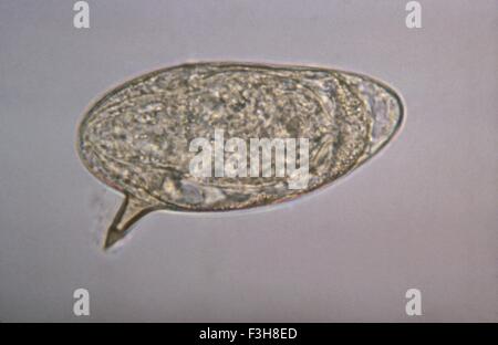 Schistosoma Parasite Worm Stock Photo - Alamy