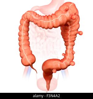 Megacolon chat