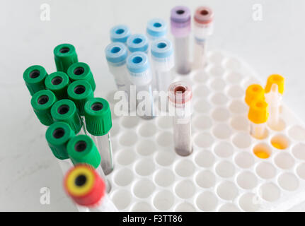 A rack of different vacuum venipuncture test tubes in a hospital. Stock Photo