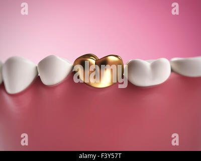 3d rendered illustration of a golden tooth Stock Photo