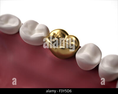 3d rendered illustration of a golden tooth Stock Photo