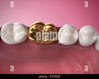 3d rendered illustration of a golden tooth Stock Photo