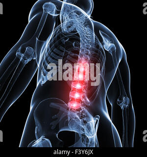 3d rendered illustration of a painful back Stock Photo - Alamy