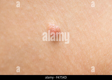 mole Stock Photo