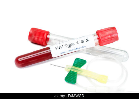 HIV type 1 and type 2 blood test collection tubes with butterfly catheter and tube holder. Stock Photo