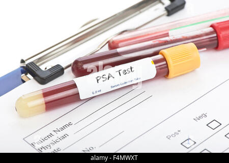 PSA-Prostate specific antigen blood test tube. A PSA test is used to ...