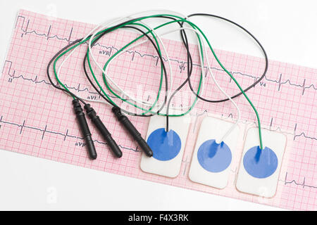 Electrocardiogram leads and electrocardiograph on white tabletop. Stock Photo