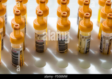 Many capillary tubes, filled with transparent serum, are sorted in a white rack Stock Photo