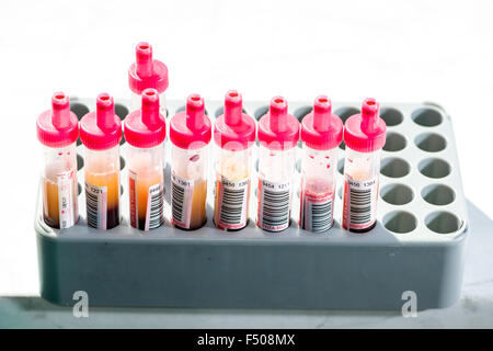 Many capillary tubes, filled with blood for diagnose the blood type, are sorted in a grey rack Stock Photo