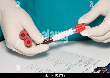 Blood collection tube with blank test label held by technician. Stock Photo