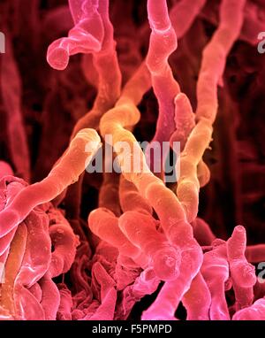 Streptomyces coelicoflavus bacteria. Coloured scanning electron micrograph (SEM) of strands of Streptomyces coelicoflavus Stock Photo