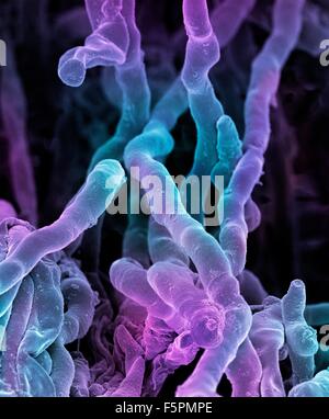 Streptomyces coelicoflavus bacteria. Coloured scanning electron micrograph (SEM) of strands of Streptomyces coelicoflavus Stock Photo