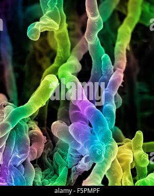 Streptomyces coelicoflavus bacteria. Coloured scanning electron micrograph (SEM) of strands of Streptomyces coelicoflavus Stock Photo