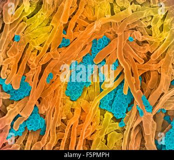 Streptomyces coelicoflavus bacteria. Coloured scanning electron micrograph (SEM) of Streptomyces coelicoflavus bacteria Stock Photo