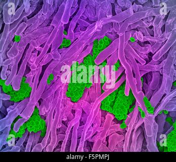 Streptomyces coelicoflavus bacteria. Coloured scanning electron micrograph (SEM) of Streptomyces coelicoflavus bacteria Stock Photo