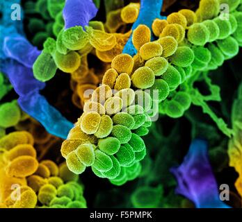 Streptococcus bacteria. Coloured scanning electron micrograph (SEM) of chains of Streptococcus bacteria with Streptomyces Stock Photo