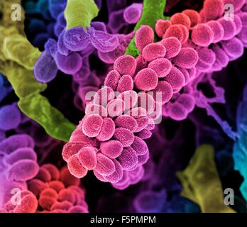 Streptococcus bacteria. Coloured scanning electron micrograph (SEM) of chains of Streptococcus bacteria with Streptomyces Stock Photo