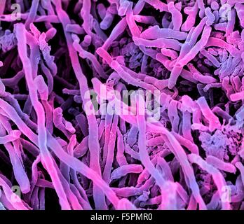 Streptomyces coelicoflavus bacteria. Coloured scanning electron micrograph (SEM) of strands of Streptomyces coelicoflavus Stock Photo